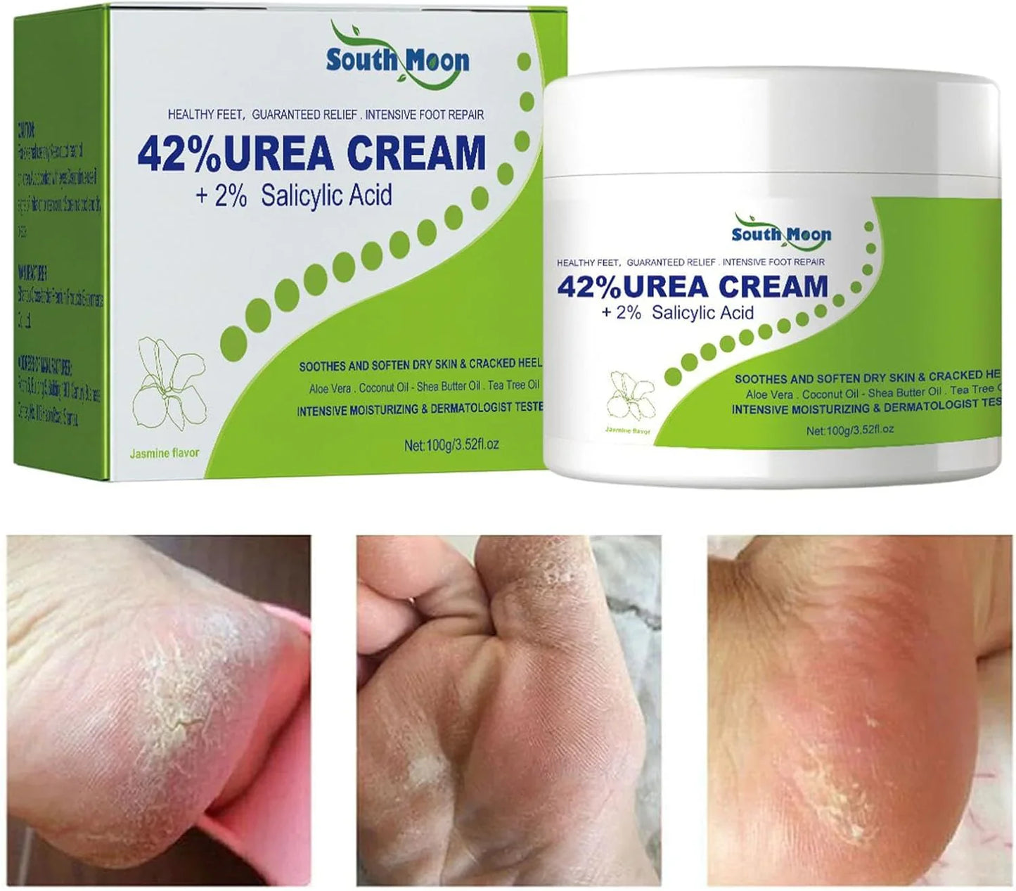 South Moon - 42% Urea Cream + 2% Salicylic Acid (Original)